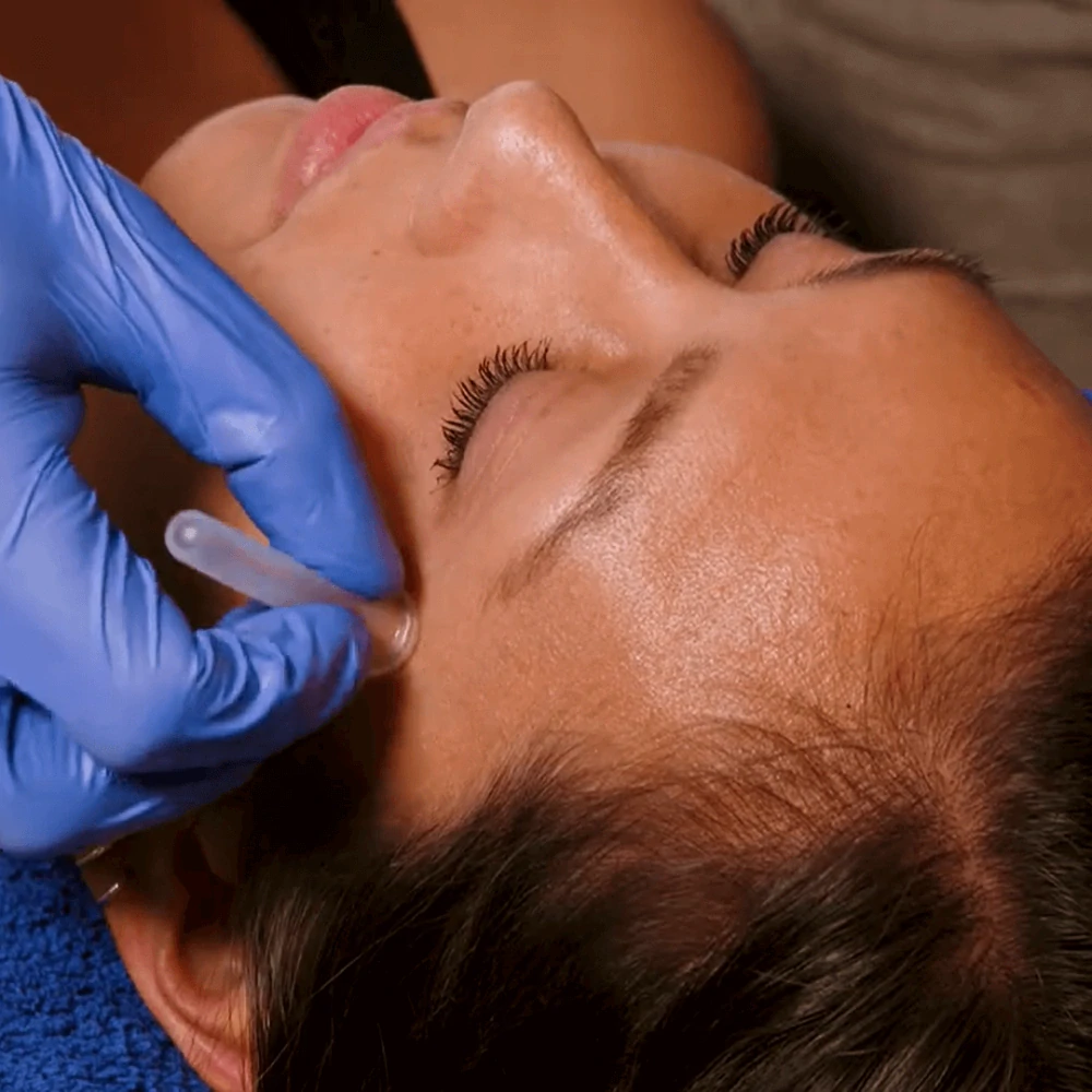 FASCIQ® Sada baněk na obličej