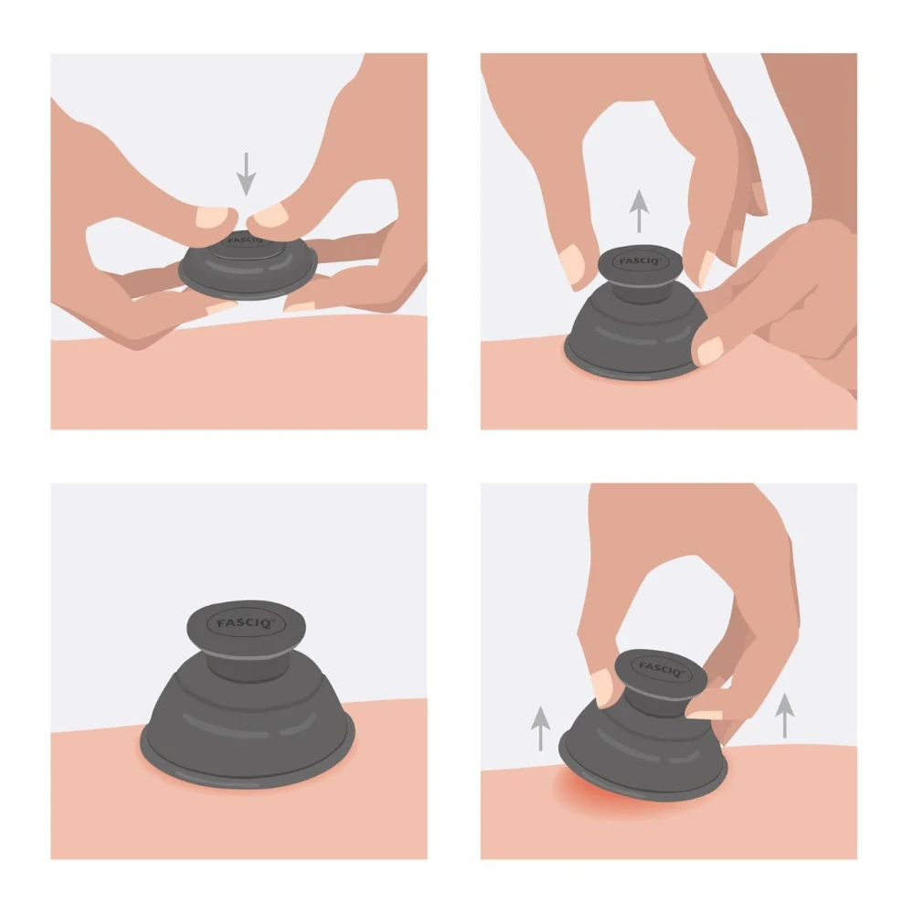 FASCIQ® Kompletní sada baněk